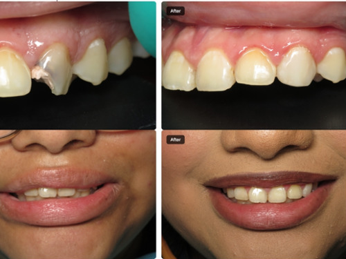 Thank you Dr. Ghazzouli!